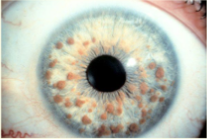 <p>Describe and give diagnosis </p>
