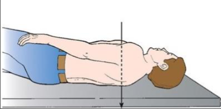 <p>What position and projection is this?</p>