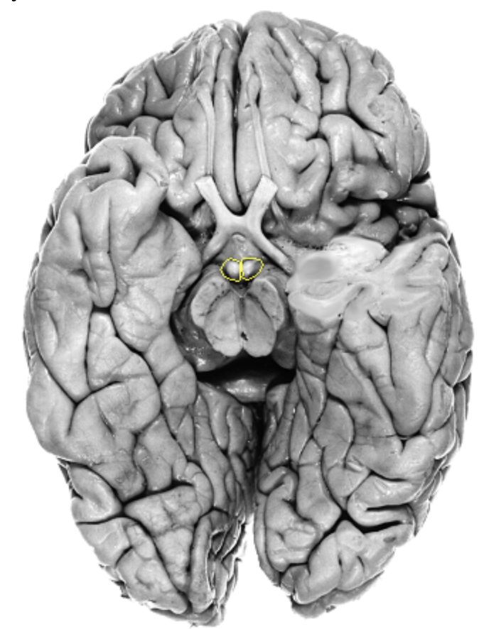 <p>What is the area highlighted called?</p>