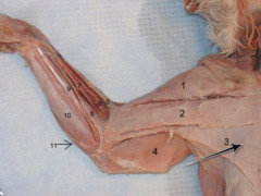 <p>muscle that acts with the superficial muscles of the ventral chest to rotate the forelimb and to draw the forelimb toward the chest</p>