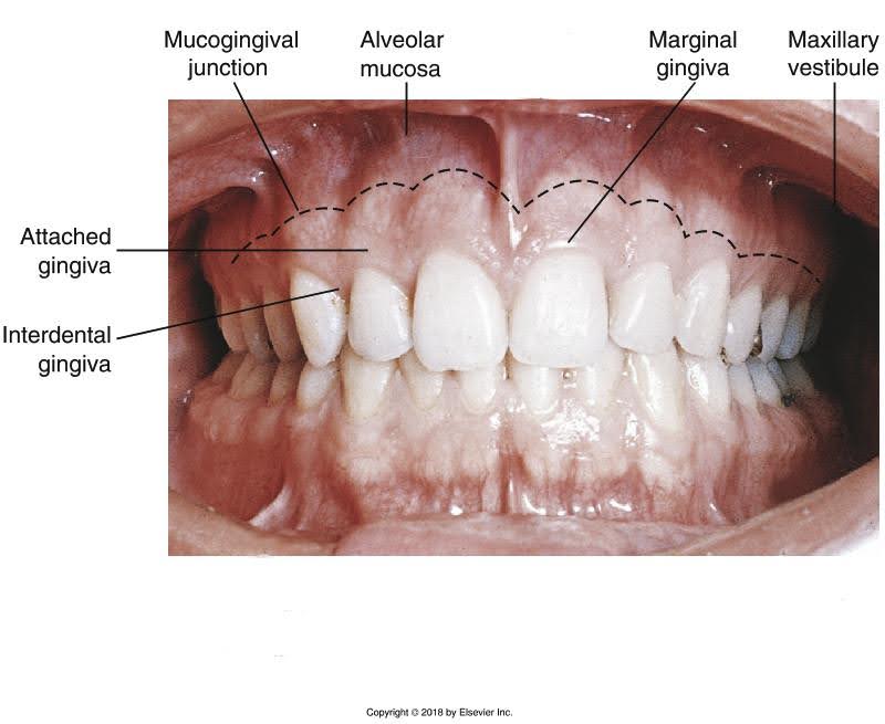 <p>Tip of papilla </p><p>Full papilla </p><p>Gingival margin</p><p>Attached gingiva </p><p>Buccal mucosa </p><p>Bone exposure </p><p>Facial perforation </p>