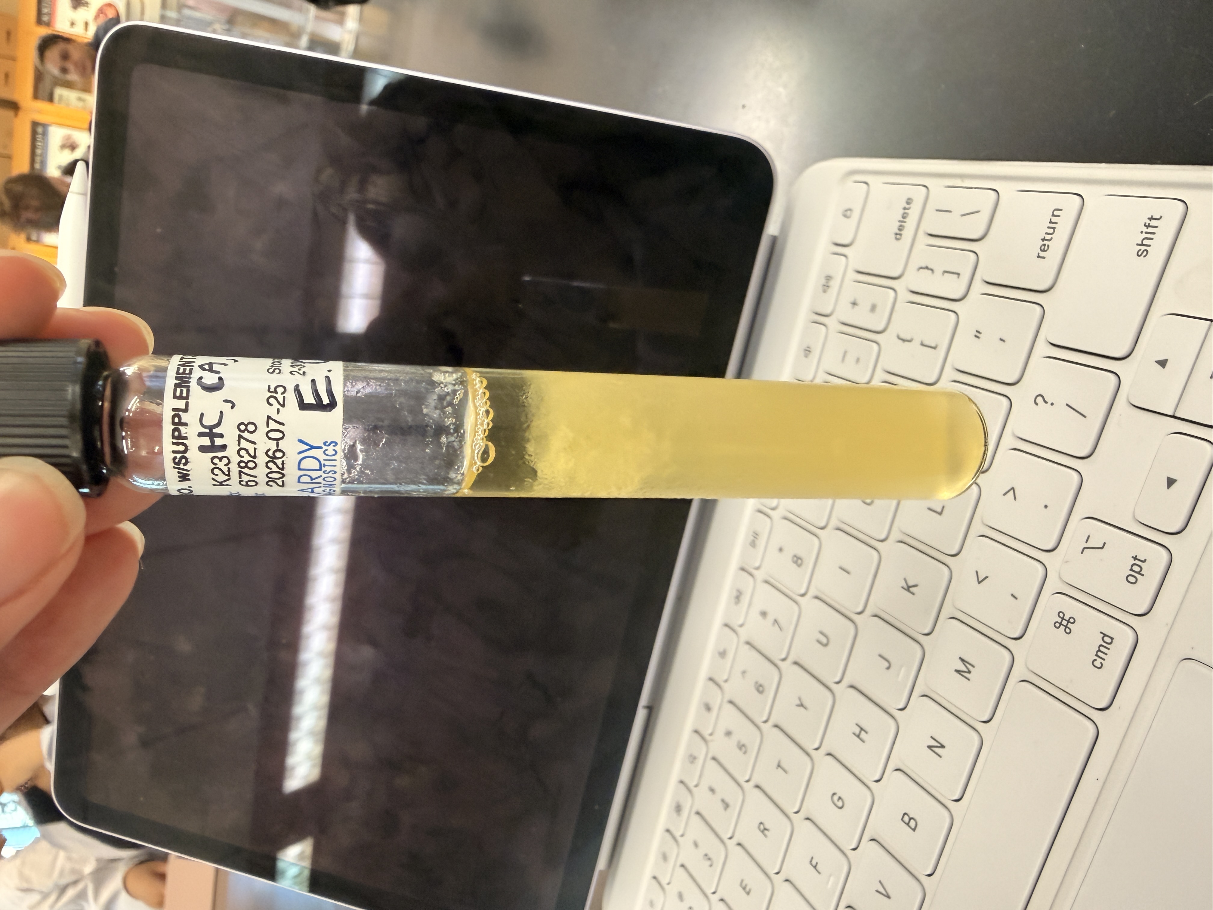 <p>E. Coli</p>