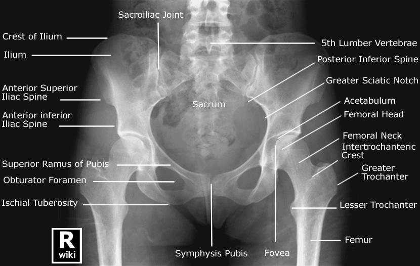 <p>What is the deep, cup-shaped cavity that accepts the head of the humerus to form the hip joint?</p>
