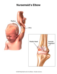<p>1-3</p><p>child will not move arm</p>