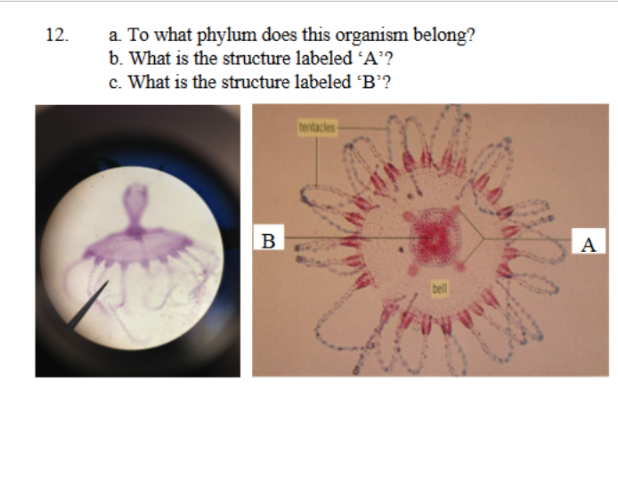 <p>what is it </p><p>phylum</p><p>a</p><p>b</p>
