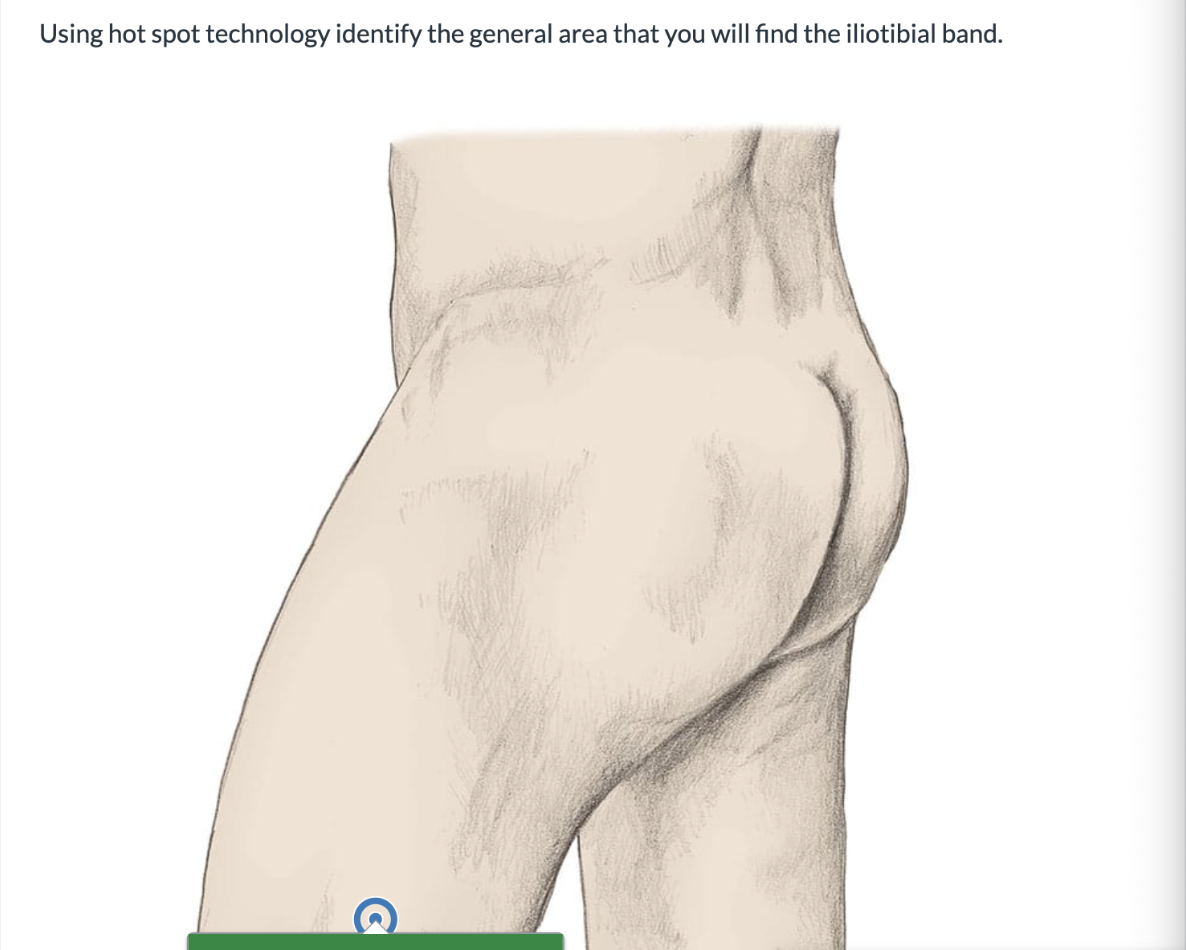 <p>Using hot spot technology identify the general area that you will find the iliotibial band. </p>