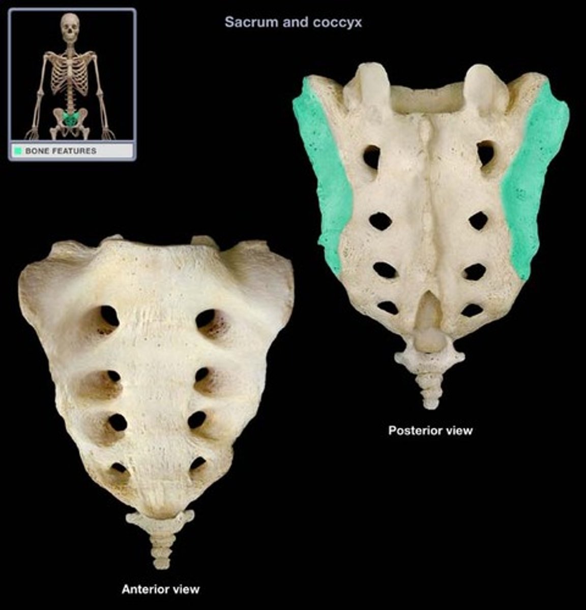 <p>Sacroiliac joint surface</p>