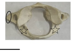 <p>what is marked? (not the star)</p>