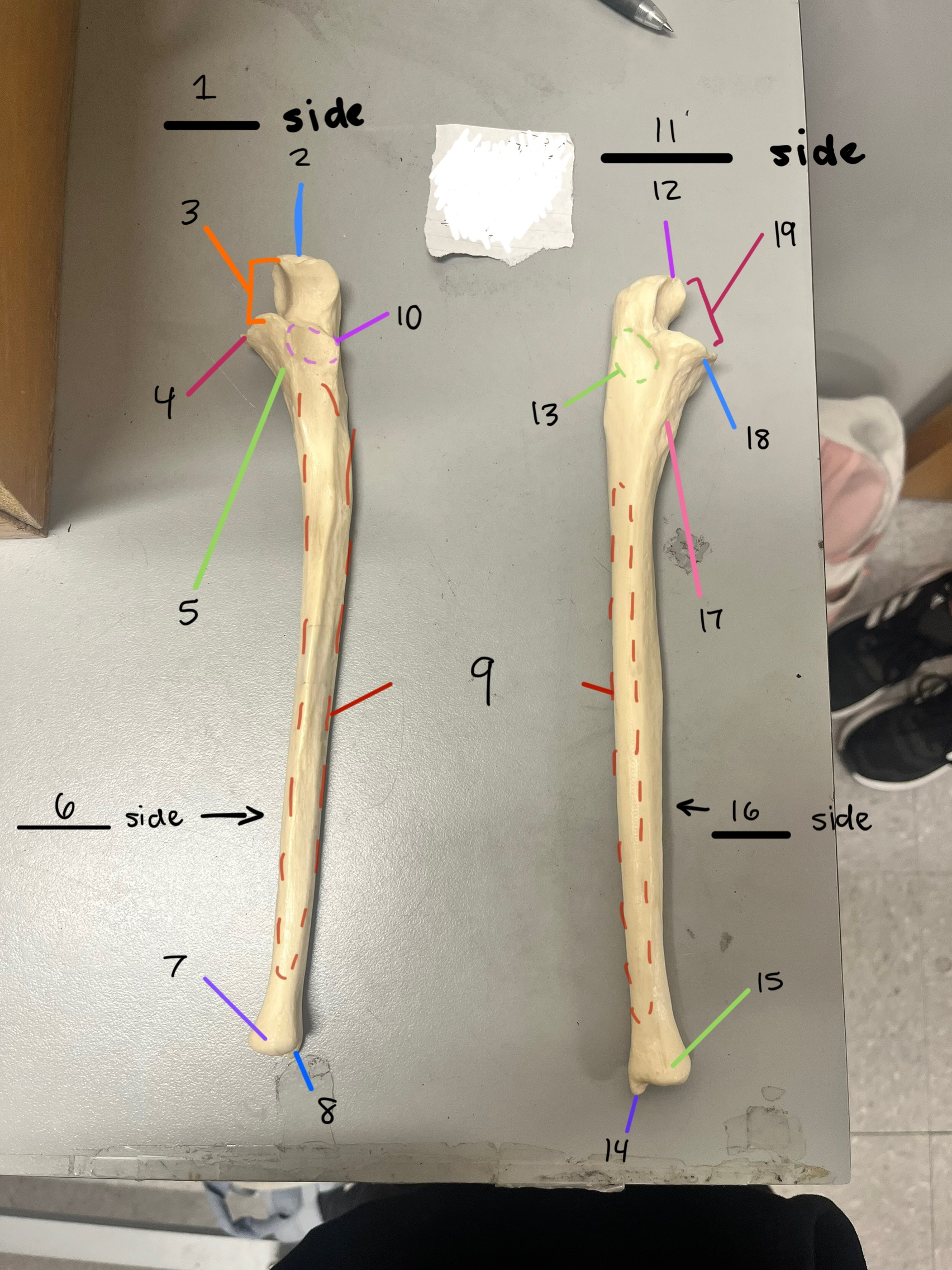 <p>8 (kind of hidden) </p>