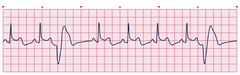 <p>identify the rhythm</p>
