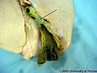 <p>what structure is being indicated to?</p>