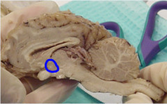 <p>Identify this structure; Name a hormone</p>