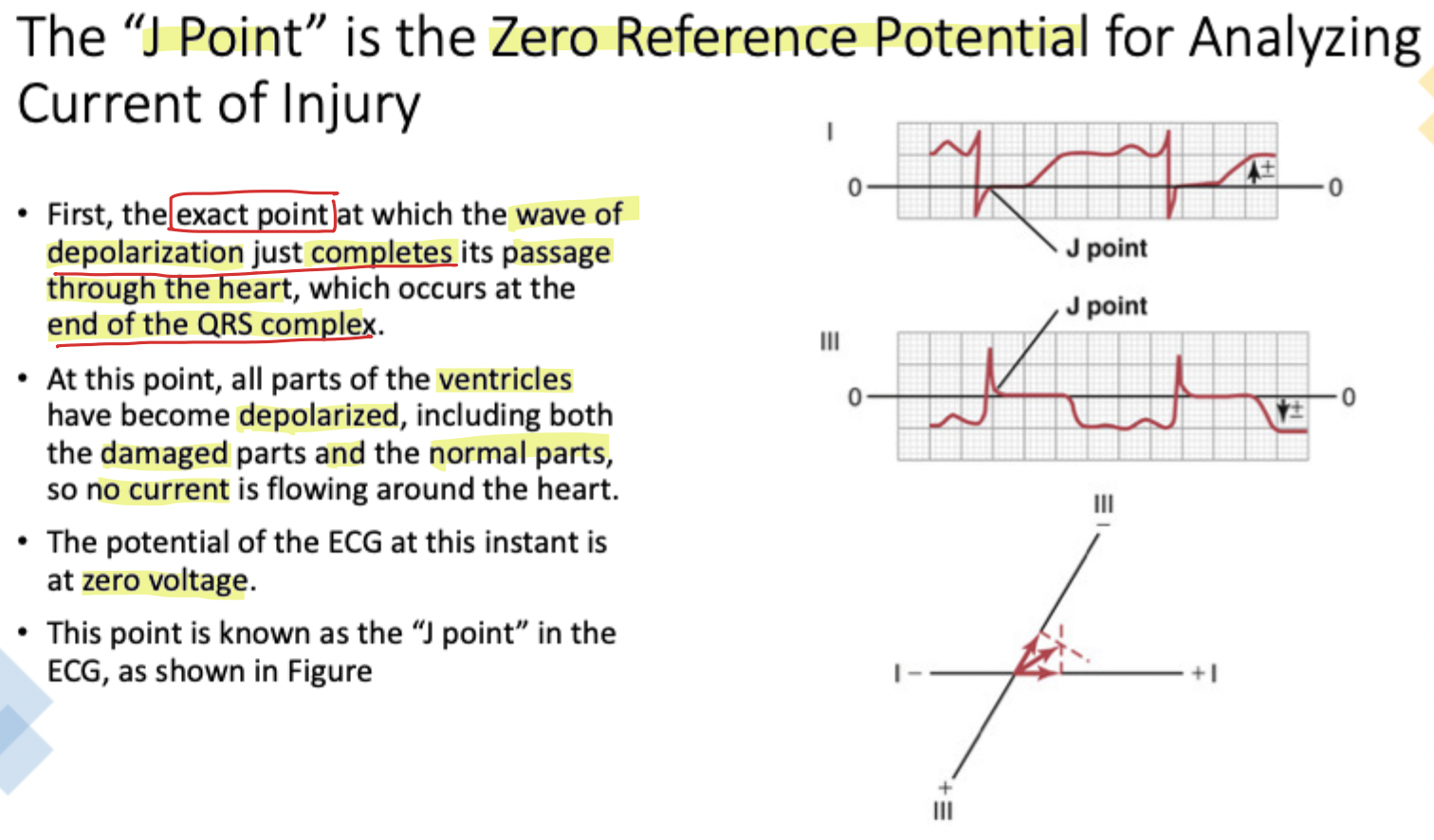 <p>The <strong><em>zero-reference potential</em></strong><em> marking the <u>end of the QRS</u></em> complex where <em>depolarization completes</em></p>