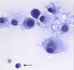 <p>Is this cytology consistent with normal, inflammatory, or noninflammatory joint disease?</p>