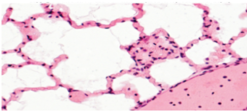 <p>Slide 1</p>