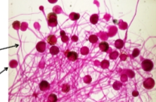 <p>what phylum is this</p>