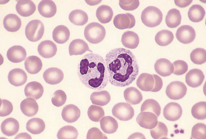 <p>What type of leukocytes are these?</p>