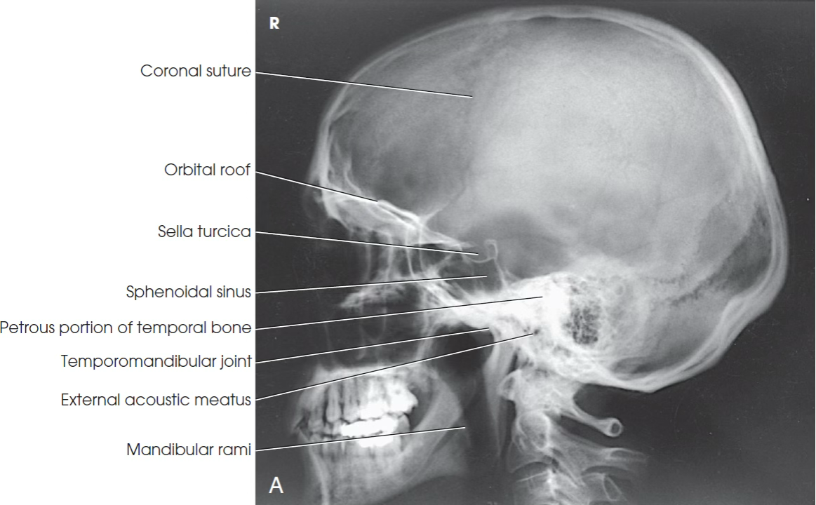 <p>What view is this?</p>
