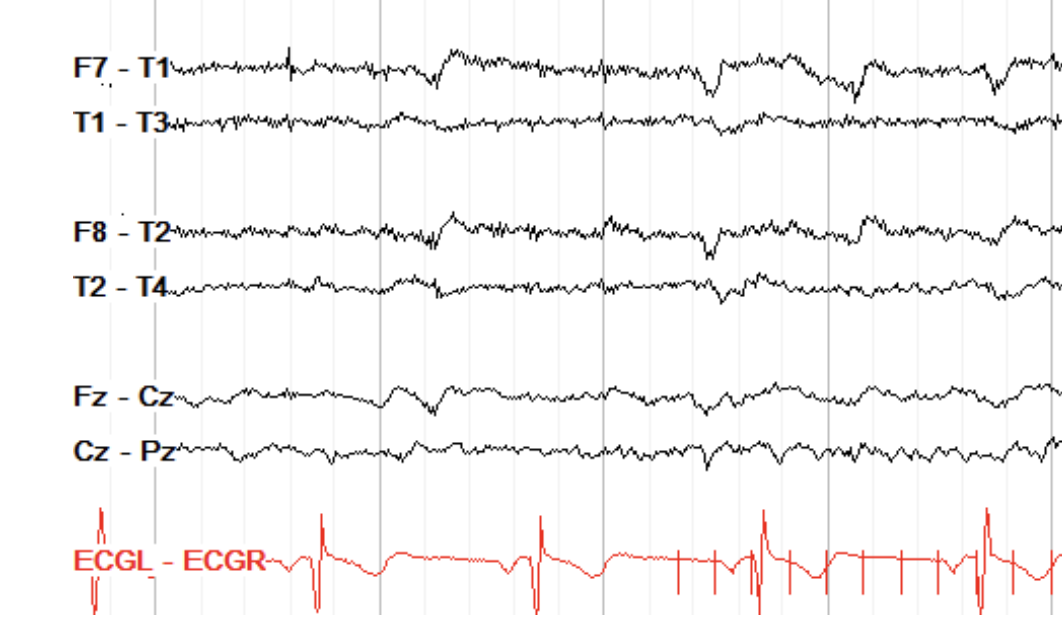 <p>Light flash in sync with reactivity, symmetrical, </p>
