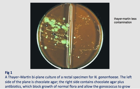 <p>Vancomycine-colistine-nystatine-trimethoprim</p><p>Selectieve plaat gebruikt voor de isolatie van Neisseria meningitidis uit de nasofarynx</p><ul><li><p>Chocolade-agar → vrijgestelde groeifactoren (voedingstoffen) door lyse van bloed</p></li><li><p>Vancomycine → remt grampositieven</p></li><li><p>Colistine → remt gramnegatieven (behalve Neisseria)</p></li><li><p>Nystatine → remt schimmels</p></li><li><p>Trimethoprim → remt o.a. Proteus</p></li></ul><p>Thayer-Martin medium (bi-plaat) → speciaal voor Neisseria gonorrhoeae (uit genitale/faryngeale stalen) </p><ul><li><p>De ene helft → enkel chocolade-agar </p></li><li><p>De andere helft → chocolade-agar met antibiotica VCNT (onderdrukking van de normale flora) </p></li></ul><p></p>