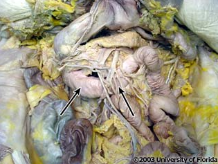 <p>what structure is pictured (be specfic; context: transverse colon and stomach have been reflected)?</p>