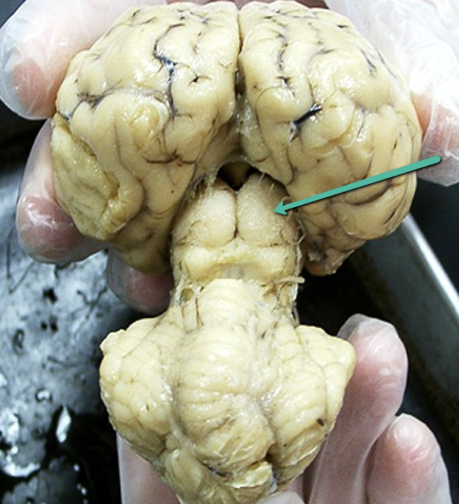 <p>Identify the structure indicated by the pointer.</p>