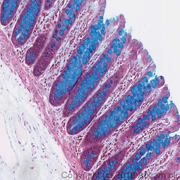 <p>Identify</p>