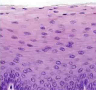<p><strong>stratified squamous</strong>: function</p>