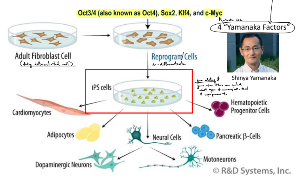 <p>a method is used to <u>reprogram / de-differentiate human somatic cells that are fully differentiated</u> back <u>into a stem cell-like state called </u><strong><u>induced pluripotent stem cells</u></strong></p><ul><li><p>where the fully-differentiated adult somatic cells are added together with <strong><u>4 Yamanaka factors</u></strong>: <strong><u>Oct4, Sox2, Klf4, c-Myc</u></strong></p></li></ul><p>iPSCs can differentiate in 6 possible types of cells:</p><ul><li><p>blood cells</p></li><li><p>pancreatic cells</p></li><li><p>motoneurons</p></li><li><p>dopamine-producing neurons</p></li><li><p>adipocytes</p></li><li><p>cardiomyocytes</p></li></ul><p>true</p><p></p>