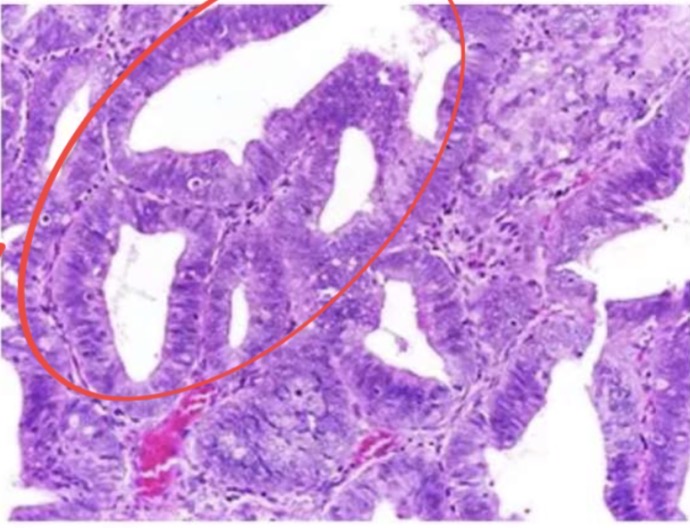 term image