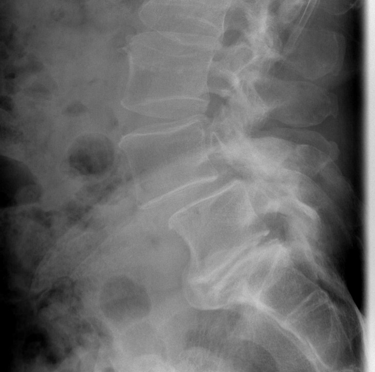 <p>What is the diagnosis?</p>