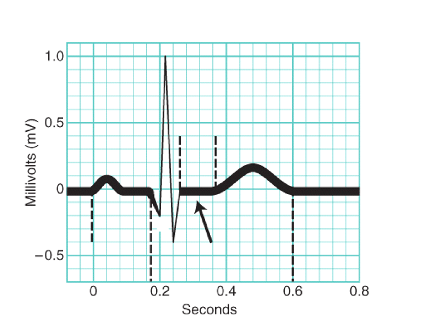 <p>the ventricles contract</p>