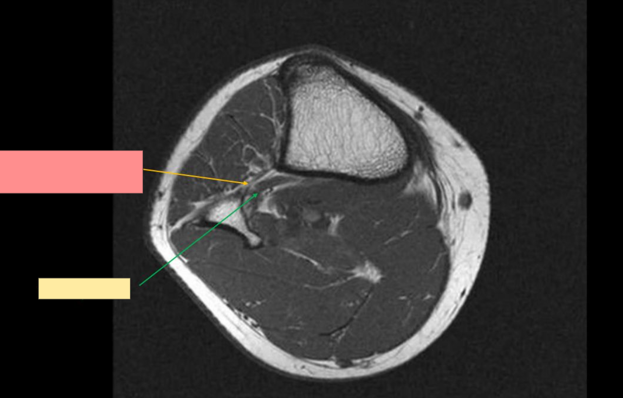 <p>Identify the structure</p>