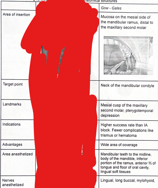<ul><li><p>nerves anaesthetised - (cut off in the picture) auriculotemporal</p></li><li><p>Patient = wide open mouth, Extended neck</p></li><li><p>procedure:</p></li></ul><ol><li><p>ask the patient to open mouth as wide as possible</p></li><li><p>retract cheek</p></li><li><p>locate the mesial cusp of Maxillary second molar (intraoral landmark)</p></li><li><p>insert needle distal to second molar at the height of the mesolingual cusp</p></li><li><p>aim for neck of condyle (needle directed toward tragus)</p></li><li><p>advanced needle until bone is gently contacted</p></li><li><p>withdraw slightly, aspirate</p></li><li><p>inject</p></li></ol><p></p>