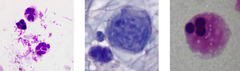<p>What is this stain and are you concerned if you see these in spermatozoa?</p>