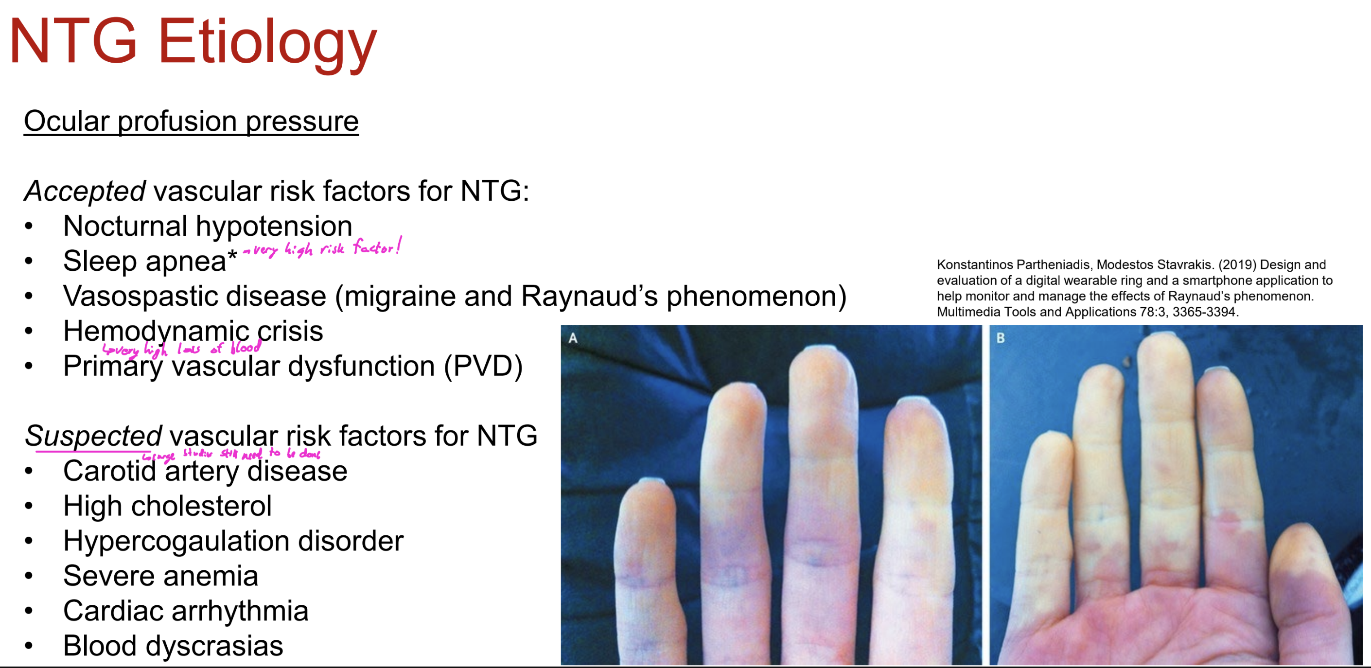 <p>What are the ACCEPTED vascular risk factors for NTG?</p>