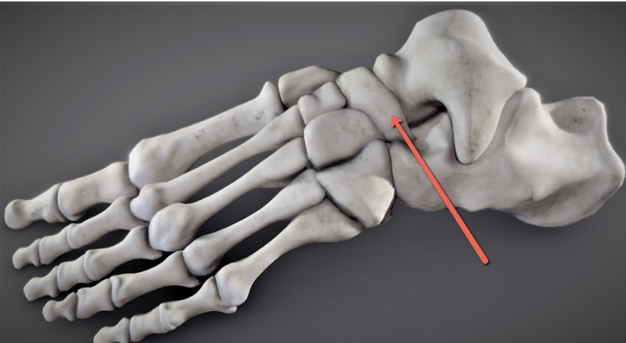 <p><strong>Identify the bone marking indicated by the pointer.</strong></p>