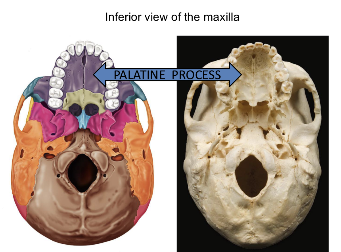 <p>Palatine Bone <strong>Facial bones = bones of face but NOT around brain</strong></p>