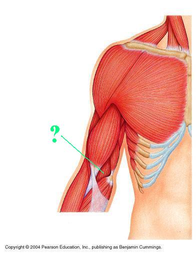 <p>Identify the indicated muscle</p>
