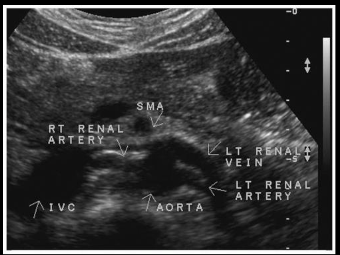 <p>What pathology comes from this</p>