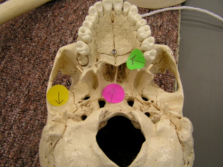 <p>Identify the structure labeled with the arrow on the pink dot. </p>