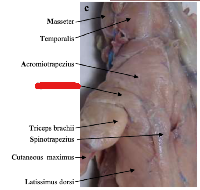 <p>Shoulder</p>
