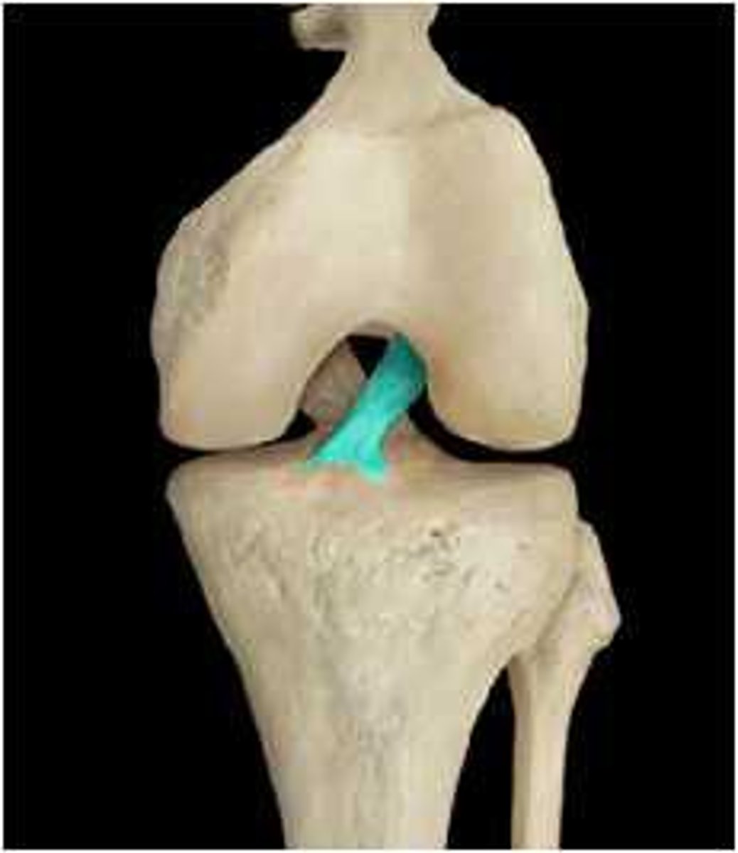 <p>Attaches to the anterior part of the tibia, in the intercondylar area. From there, it passes posteriorly to attach to the femur on the medial side of the lateral condyle. The ACL prevents anterior displacement of the tibia on the femur and provides rotational stability to the joint.</p>