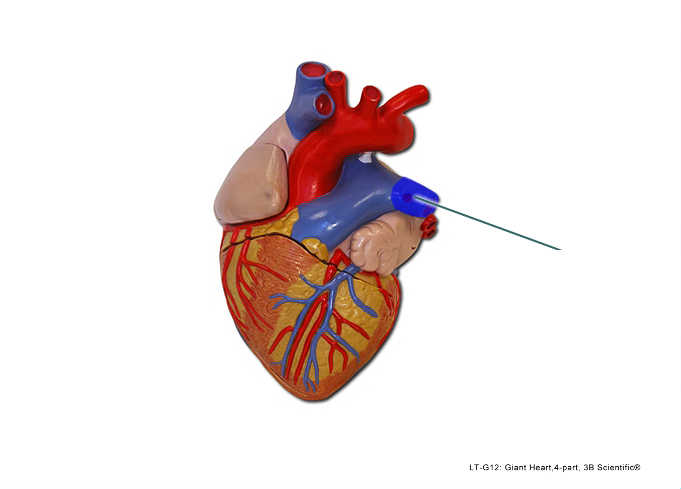 <p>Identify the highlighted vessel.</p>