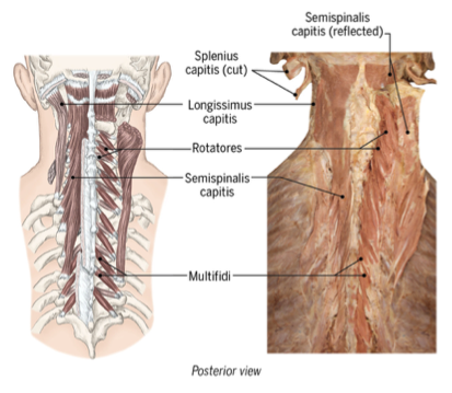 <p>multifidi, rotatores, semispinalis capitis</p><p></p><p>connect individual vertebrae</p>