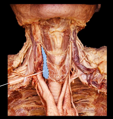 <p>what the structure is?</p>