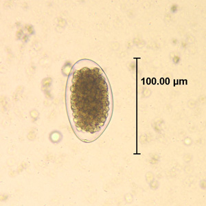 <p>trichostrongylus spp.</p>