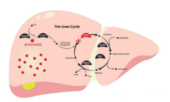 <p>When excess carbamoyl phosphate leaks into the cytosol, diverting into pyrimidine synthesis pathways, leading to the production of orotic acid, what does this result in </p>