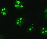 <p>bright, glowing nucleoli, bubbles</p>