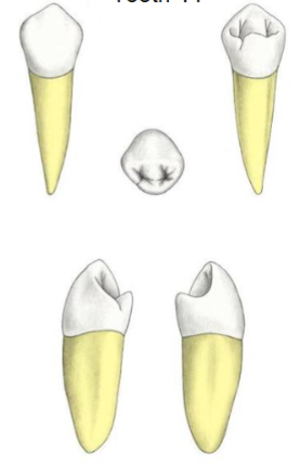<p>Which tooth?</p>